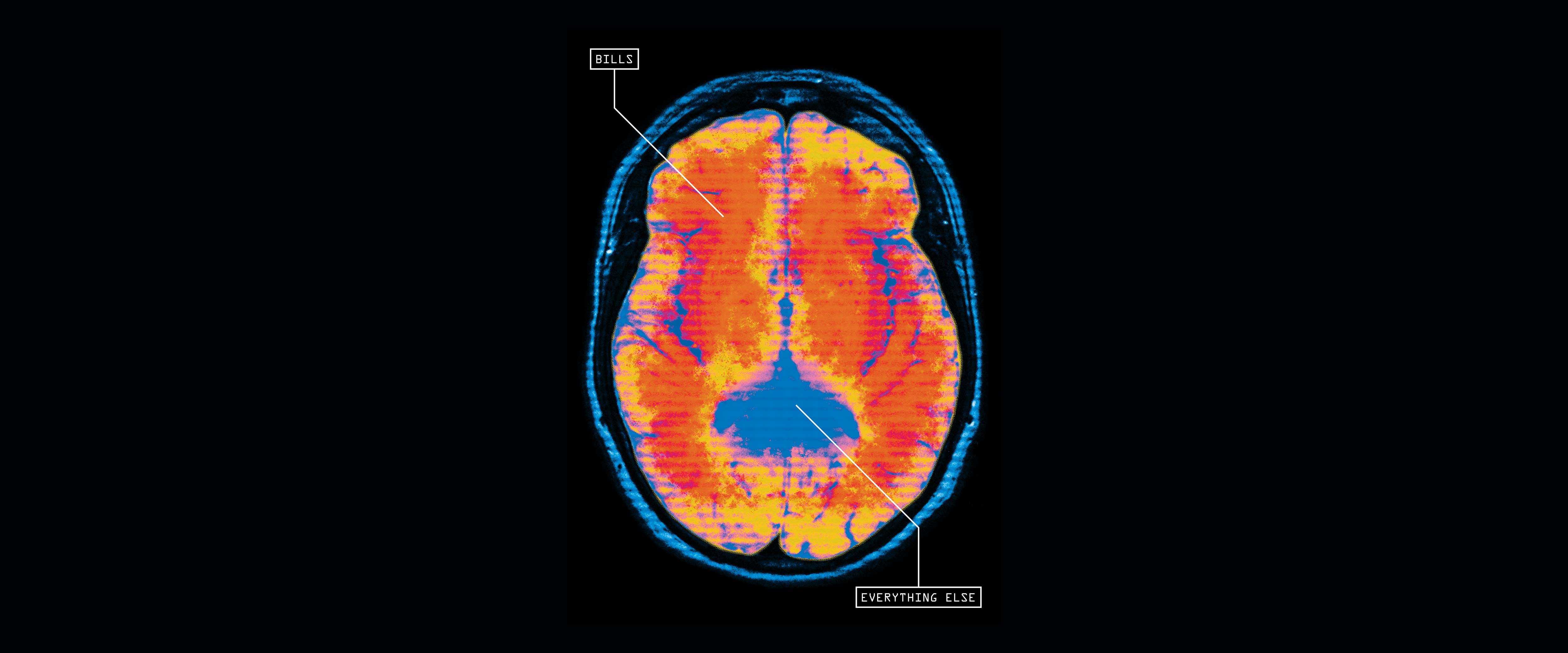 Brain image