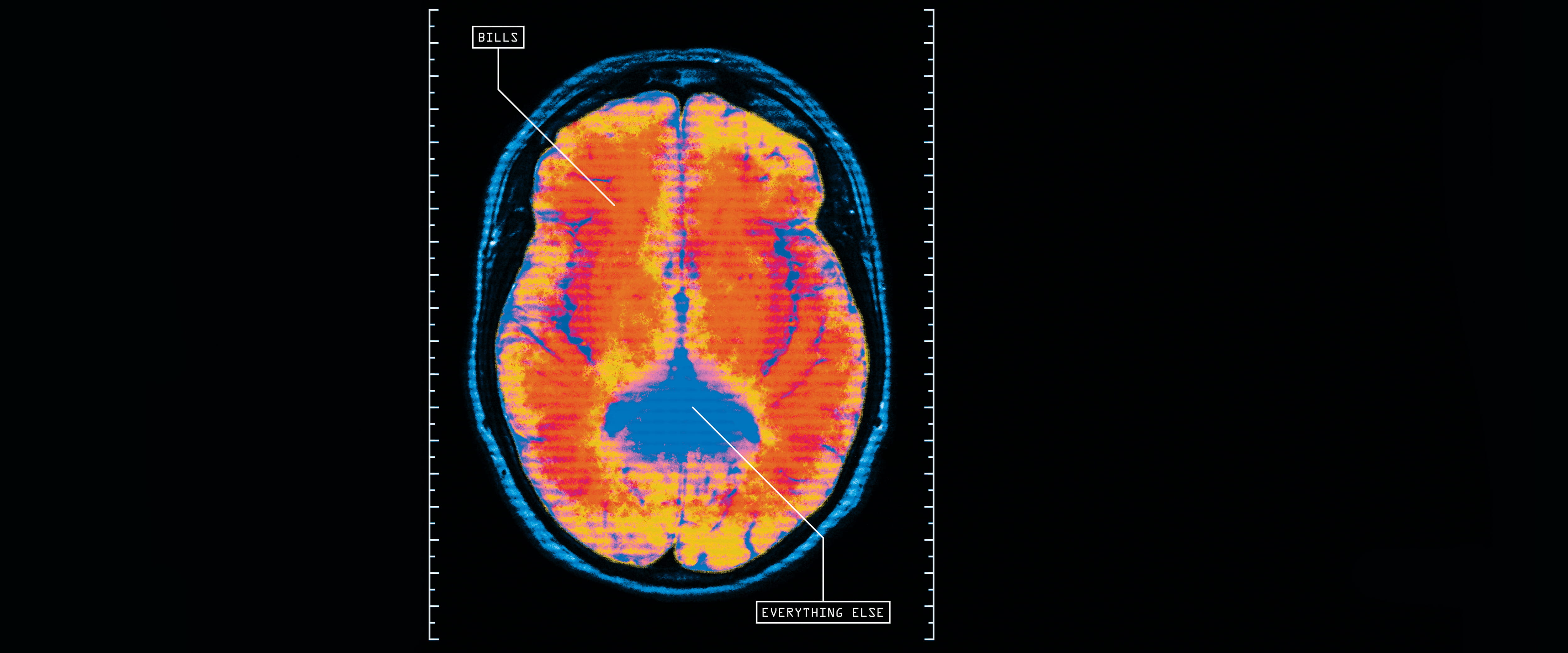 Brain scan showing both hemispheres, with arrows indicating active areas for ‘bills’ and less active areas for ‘everything else’